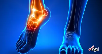 چرا سلامت پاها مهم است؟