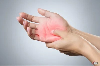 بهترین و بدترین خوراکی‌ها برای درد آرتروز