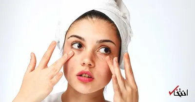 چرا پوستم همیشه خراب و پر از لک و جوش است؟