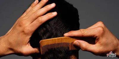 چرا کرونا باعث ریزش مو می‌شود؟