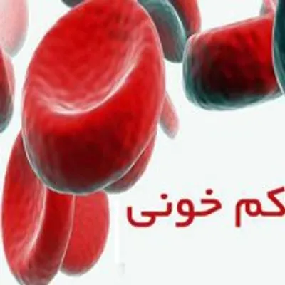 شیوع کم خونی فقر آهن در کشور