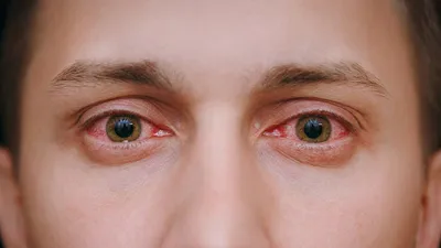 حفظ سلامت چشم‌ها در فصل سرما