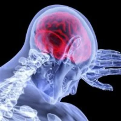 وجود توده های کلسیم در مغز نشانه پارکینسون است