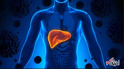چگونه از سرطان کبد پیشگیری کنیم؟