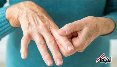 آرتروز چیست و چگونه درمان می شود؟