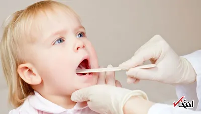 عفونت لوزه چیست و چه علائمی دارد؟