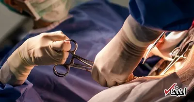 شبیه سازی سزارین در یوتیوب حاشیه ساز شد