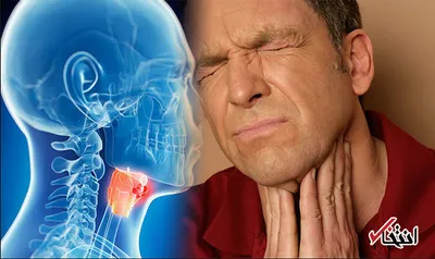 چگونه گرفتگی صدایم را درمان کنم؟