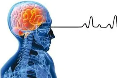 فلوراید با مغزتان چه می‌کند